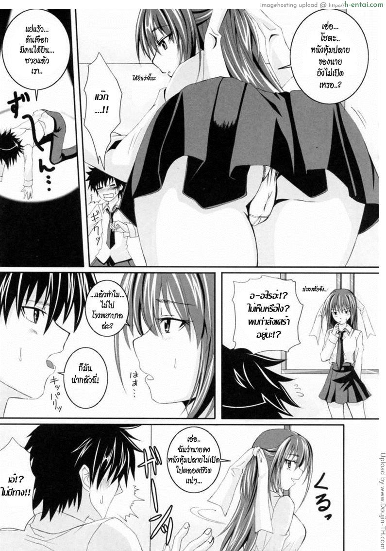 ช่วยด้วย หนังหุ้มปลายผมไม่เปิด - แผ่น 3